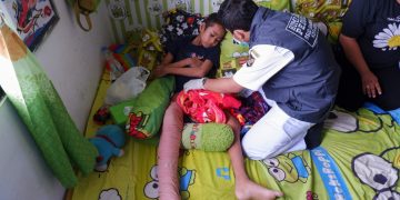 Derita Elang, Bocah Penderita Kanker di Rusunawa Kediri