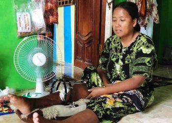 Kisah Pilu Ibu Asal Bangkalan Pasca 3 Tahun Kecelakaan