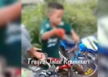 Miris, Bocah 9 Tahun Tuntun Sepeda Dengan Tangan Hancur