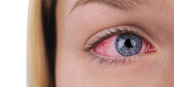 Ilustrasi sakit mata. Foto: Unsplash