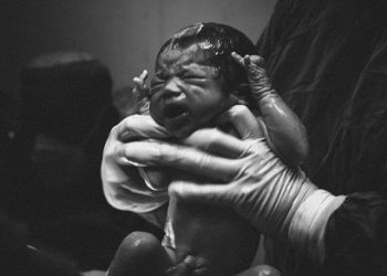 Terjepit Jalan Rahim Saat Persalinan, Kepala Bayi ‘Dipisah’