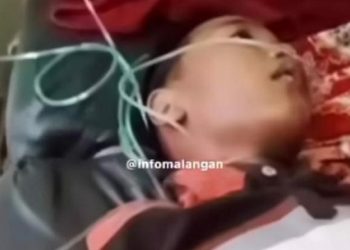 Kondisi anak kelas 2 SD usai dianiaya kakak kelas. Foto: tangkapan layar