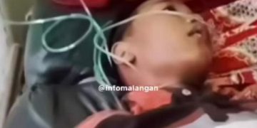 Kondisi anak kelas 2 SD usai dianiaya kakak kelas. Foto: tangkapan layar