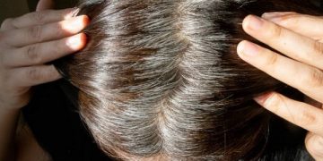 Ilustrasi rambut putih. Foto: Unsplash