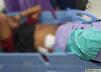 Tidur di Kafe, 2 Pemuda Ditembak Senapan Angin