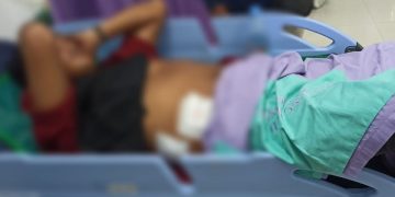 Salah satu teman korban yang menderita luka tembak senapan angin. Foto: Bacaini