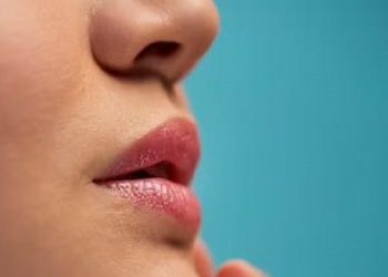 5 Cara Alami Mengatasi Bibir Kering dan Pecah-pecah