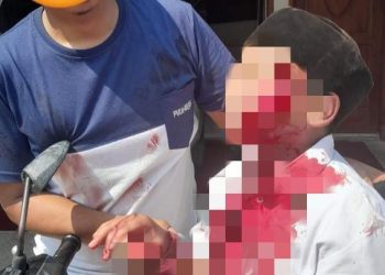 Wajah Bocah SD di Malang Diduga Disayat Cutter, Polisi Hati-hati Lakukan Penyelidikan  