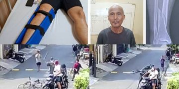 Viral Ketua RW Dihajar Warga sampai Patah Tulang Hanya Karena Teguran. (foto: tangkapan layar)