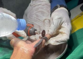 2 Cincin Warga Trenggalek Repotkan Petugas Damkar