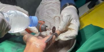 2 Cincin Warga Trenggalek Repotkan Petugas Damkar (foto/Bacaini)