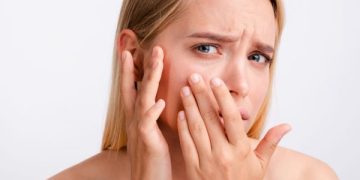 Masih Muda Tapi Kulit Sudah Kendur? Ini Penyebab Utamanya (foto ilustrasi/freepik)