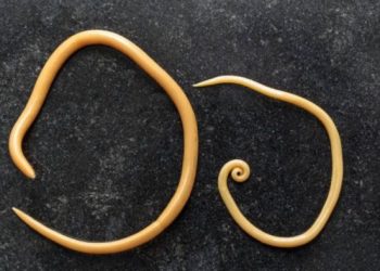 kasus cacingan merenggut nyawa balita Raya asal Sukabumi