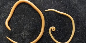 kasus cacingan merenggut nyawa balita Raya asal Sukabumi