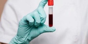 Golongan darah menentukan awet muda