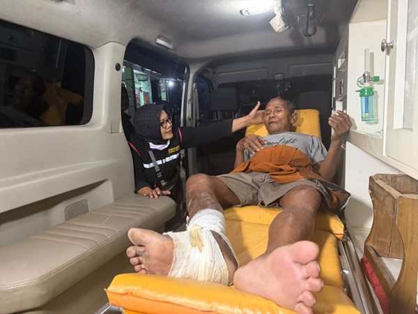 Amze Suminah, 71, warga Kecamatan Sumberbaru, Kabupaten Jember, yang mengalami luka kronis di kaki selama 15 tahun