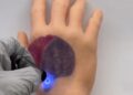 Teknologi tato PhotoTat yang dapat berubah warna saat terkena cahaya tertentu