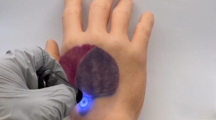 Teknologi tato PhotoTat yang dapat berubah warna saat terkena cahaya tertentu